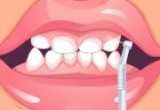لعبة تصليح الاسنان 2018