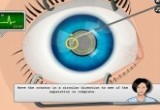لعبة علاج العيون الزرقاء 2017